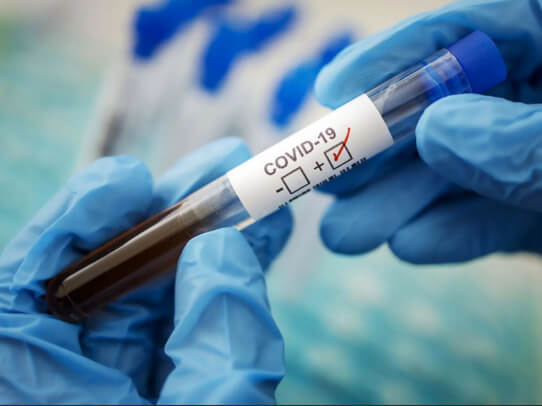 3 июля в Саратовской области зарегистрировано 63 новых случая заболевания коронавирусом